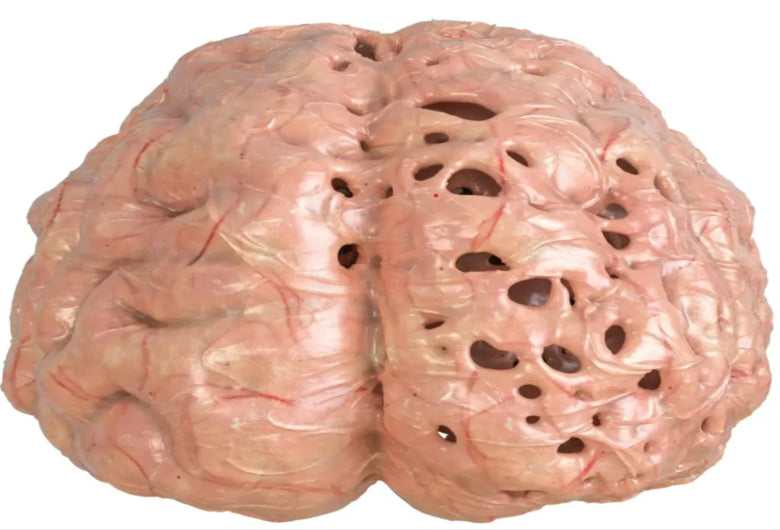 Stress is a Brain Killer